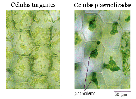 Plasmlisis